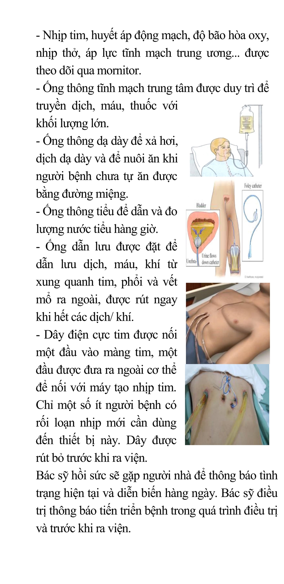 2. Phẫu thuật tim - Một số vấn đề cần được quan tâm